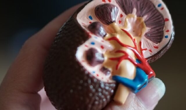 Insuffisance rénale